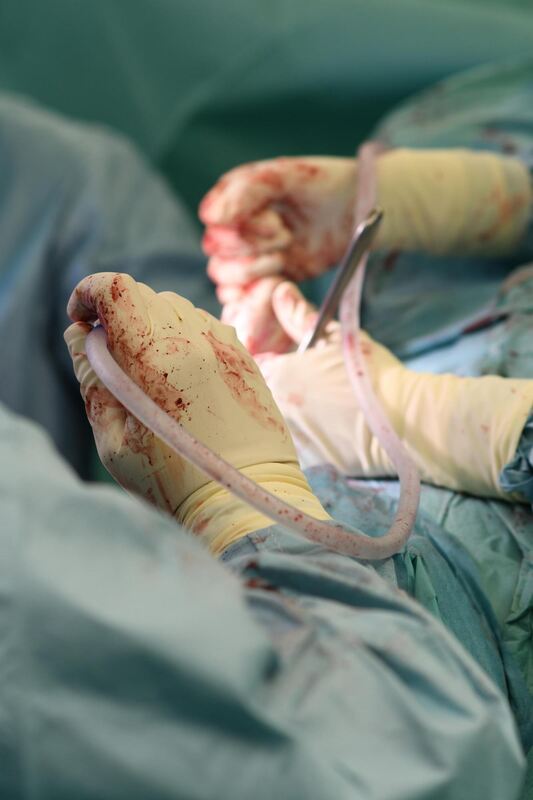 Es fließt nur wenig Blut bei einer Hüft-OP. Es fließt nur wenig Blut bei einer Hüft-OP.