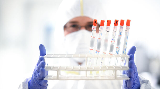 Das Coronavirus, hier ein Ständer mit diversen Abstrichen, hält das Gesundheitssystem in Europa auf Trab.  FOTO: DPA