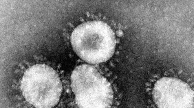 Coronavirus