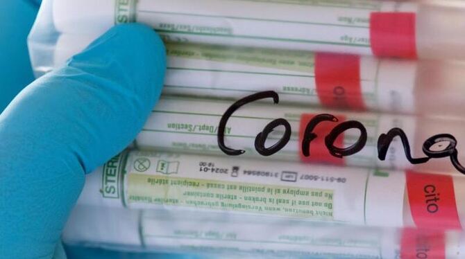 Coronavirus - Tests