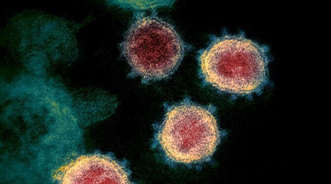 Coronavirus