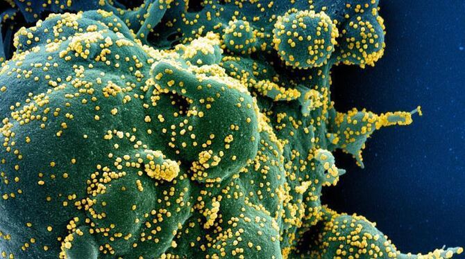 Coronavirus - Virus SARS-CoV-2