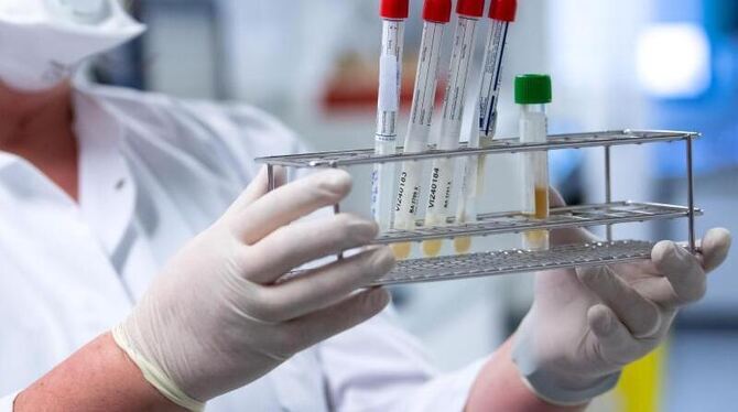 Coronavirus-Test