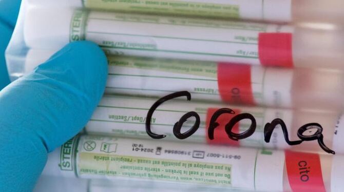 Coronavirus - Test