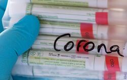 Coronavirus - Test