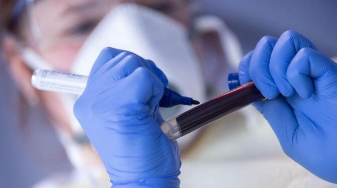 Coronatest