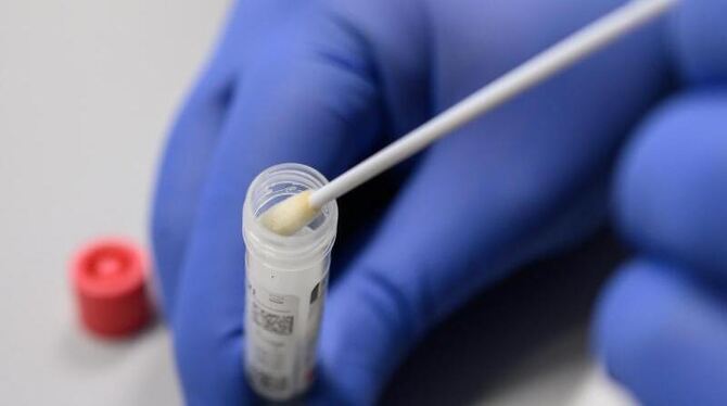 Coronavirus-Test