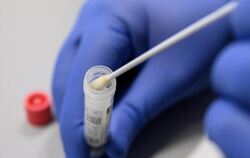 Coronavirus-Test