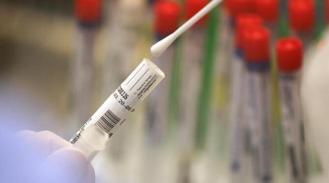 Ein Abstrich wird in einem Labor auf das Coronavirus untersucht