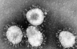 Eine Mikroskopaufnahme zeigt das Coronavirus