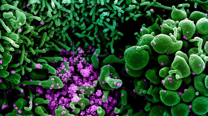 Auf dieser vom US-Forschungszentrum »National Institute of Allergy and Infectious Diseases« (NIAID) zur Verfügung gestellten Auf