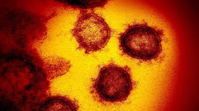 Coronavirus SARS-CoV-2