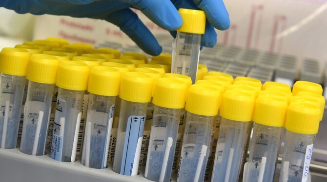 PCR-Labor