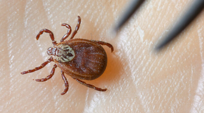 lbn, brb, Medizin, Gesundheit, Gesundheit Zecken sind nach milden Wintern früher aktiv. Sich gegen die Parasiten zu schützen, ist wichtig.